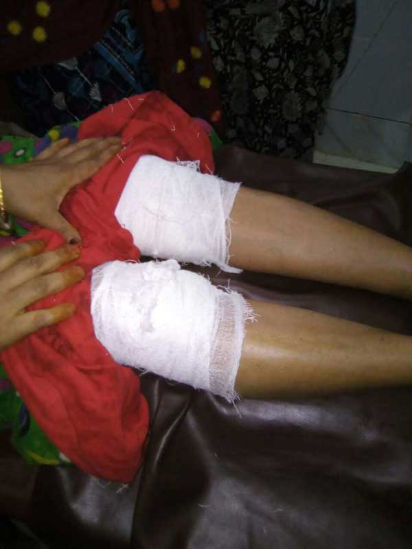 নানিয়ারচরে গুলিতে এক নারী আহত