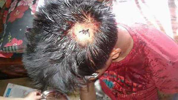 বিনা কারণেই ছাত্রলীগের মার খেলেন দুই পথচারি