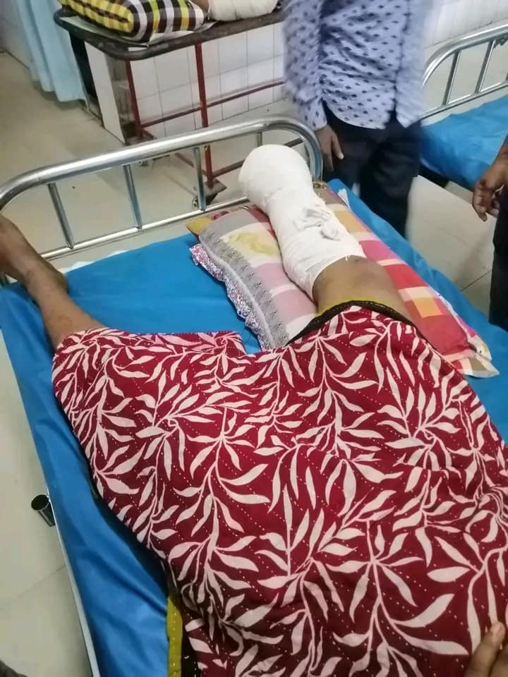 পা হারানো রাঙামাটির সন্তান পুলিশ সদস্যের পায়ে সফল অস্ত্রোপচার